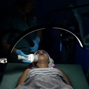 Crioradiofrecuencia facial