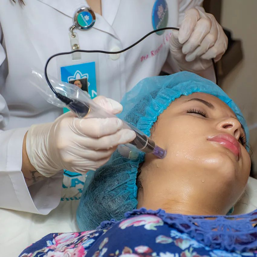 Dermapen médico, medicina estética, rostro, cuello, escote, manos