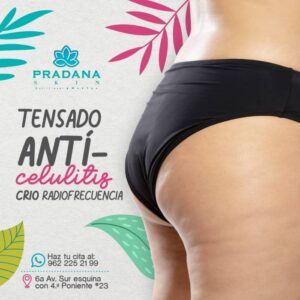 Crioradiofrecuencia: Tensado