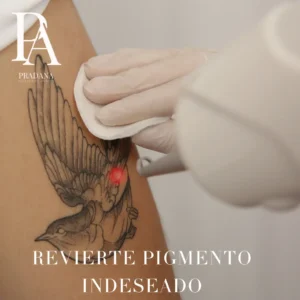 Retiro de tatuaje (laser)